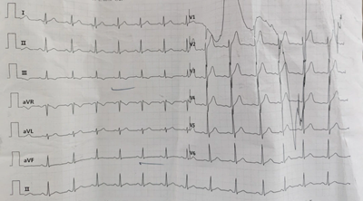 常温正能量 | “闪电侠”蒋方伟:生死瞬间的“蒙牛担当”(图3) 常温正能量 | “闪电侠”蒋方伟:生死瞬间的“蒙牛担当”(图3)